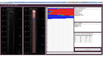 0-200μM Automated Particle Analyzer In Good Reproducibility And Accuracy For Testing Result